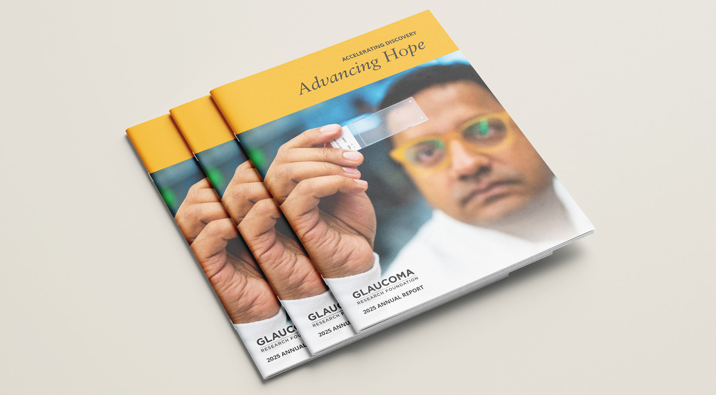 Glaucoma 2025 Annual Report covers